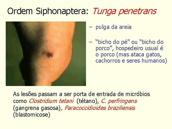Ordem Siphonaptera: Tunga penetrans – pulga da areia – “bicho do pé” ou “bicho