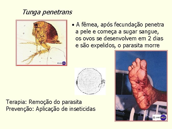 Tunga penetrans • A fêmea, após fecundação penetra a pele e começa a sugar