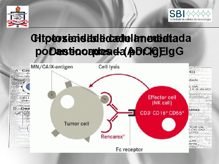  Citotoxicidade celular mediada Hipersensibilidade Imediata por anticorpos – (ADCC) Ig. G Desencadeada por