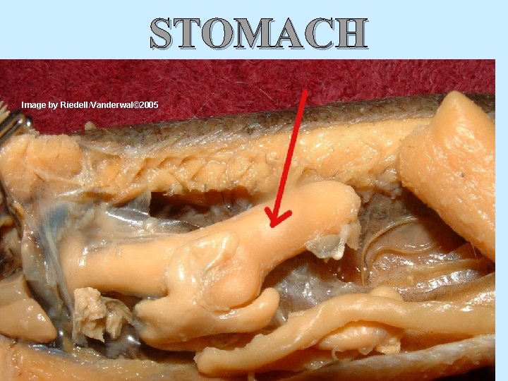 STOMACH Image by Riedell/Vanderwal© 2005 