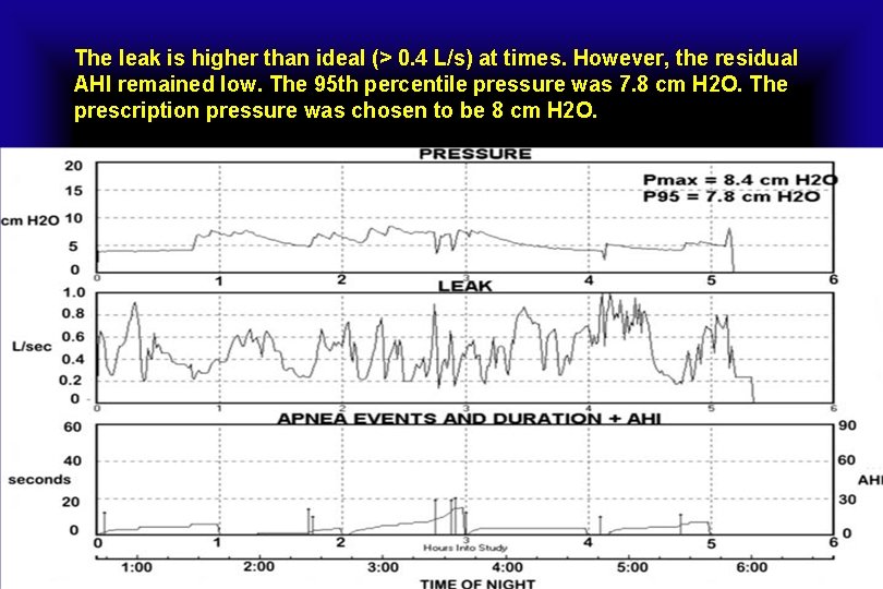 The leak is higher than ideal (> 0. 4 L/s) at times. However, the