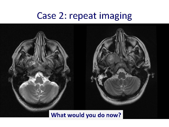 Case 2: repeat imaging What would you do now? 
