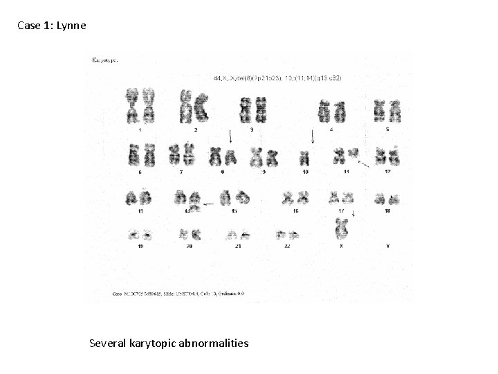 Case 1: Lynne Several karytopic abnormalities 
