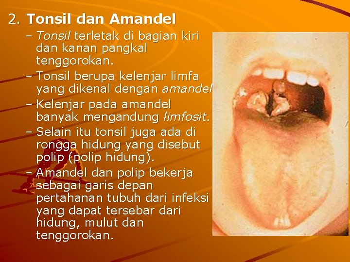2. Tonsil dan Amandel – Tonsil terletak di bagian kiri dan kanan pangkal tenggorokan.