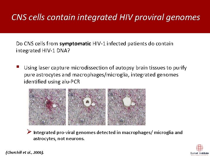 CNS cells contain integrated HIV proviral genomes Do CNS cells from symptomatic HIV-1 infected