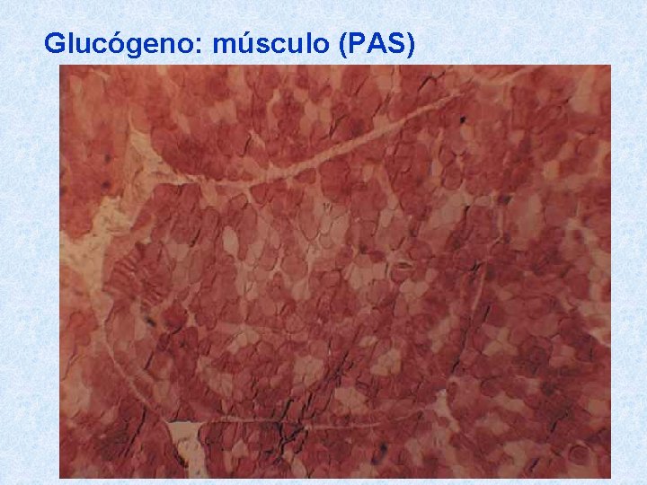 Glucógeno: músculo (PAS) 