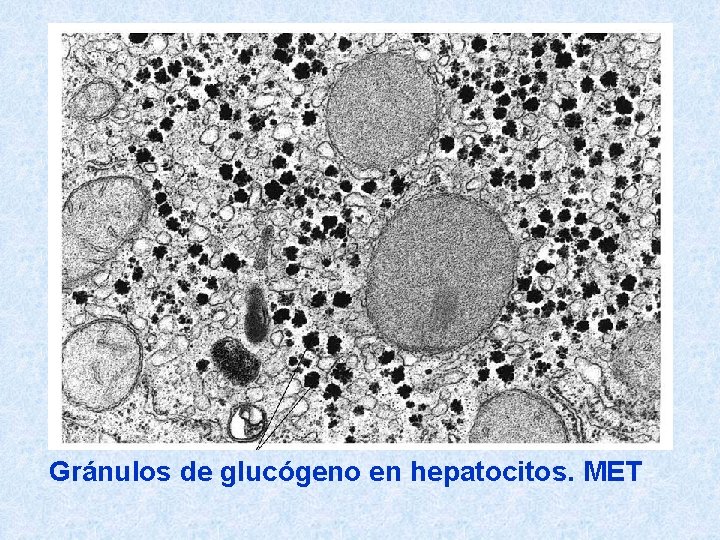 Gránulos de glucógeno en hepatocitos. MET 