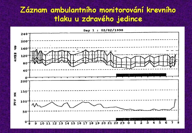 Záznam ambulantního monitorování krevního tlaku u zdravého jedince 