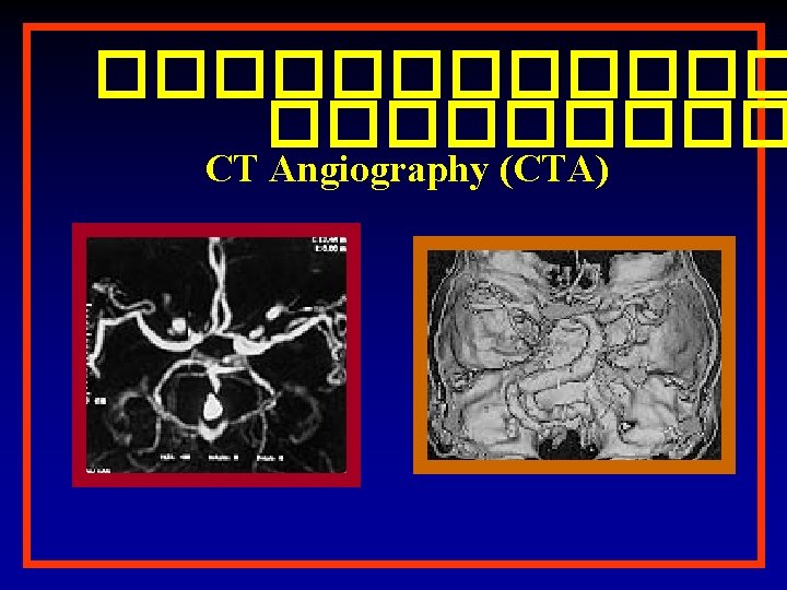 ������ CT Angiography (CTA) 