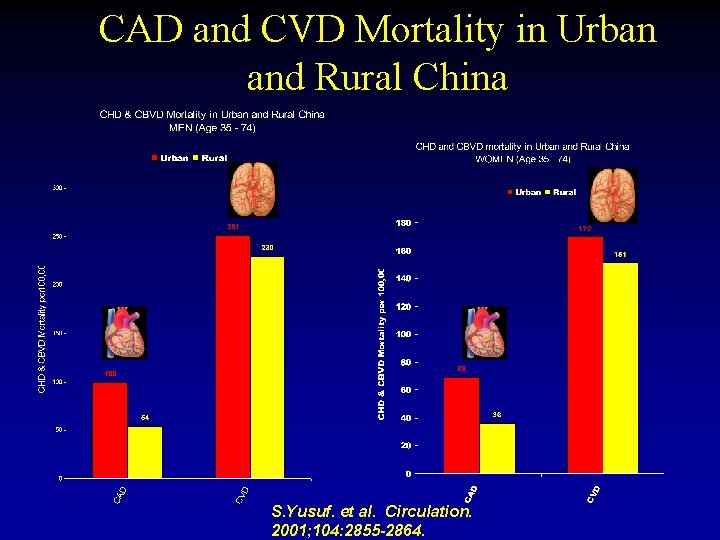 CAD and CVD Mortality in Urban and Rural China S. Yusuf. et al. Circulation.