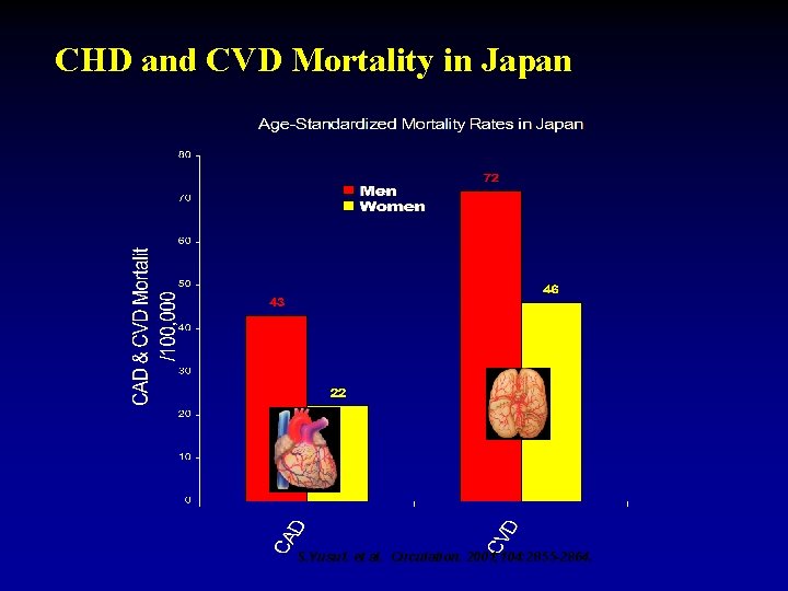 CHD and CVD Mortality in Japan S. Yusuf. et al. Circulation. 2001; 104: 2855