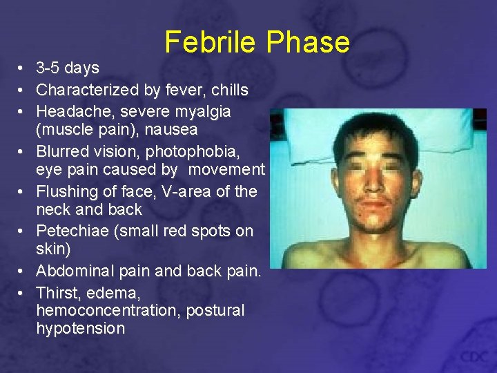 Febrile Phase • 3 -5 days • Characterized by fever, chills • Headache, severe