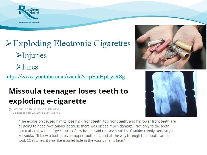 Ø Exploding Electronic Cigarettes ØInjuries ØFires https: //www. youtube. com/watch? v=p. Em. Hp. Lyr.