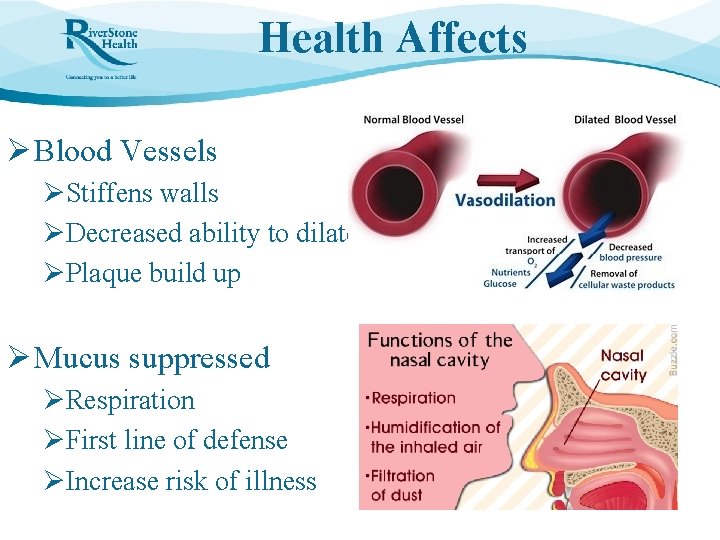 Health Affects Ø Blood Vessels ØStiffens walls ØDecreased ability to dilate ØPlaque build up