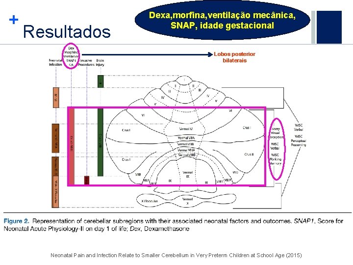 + Resultados Dexa, morfina, ventilação mecânica, SNAP, idade gestacional Lobos posterior bilaterais Neonatal Pain