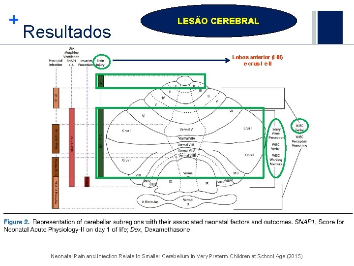 + Resultados LESÃO CEREBRAL Lobos anterior (I-III) e crus I e II Neonatal Pain