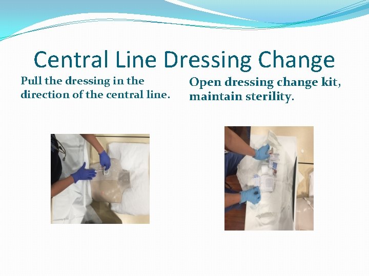 Central Line Dressing Change Pull the dressing in the direction of the central line.