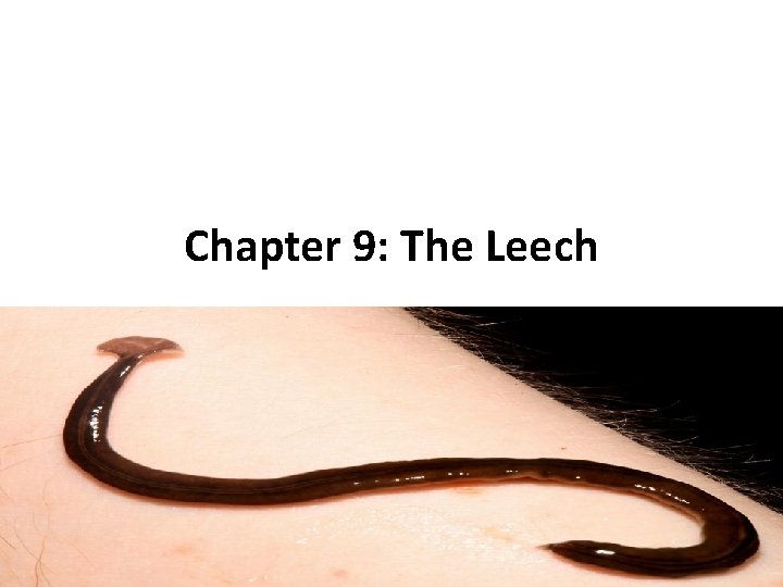 Chapter 9: The Leech 