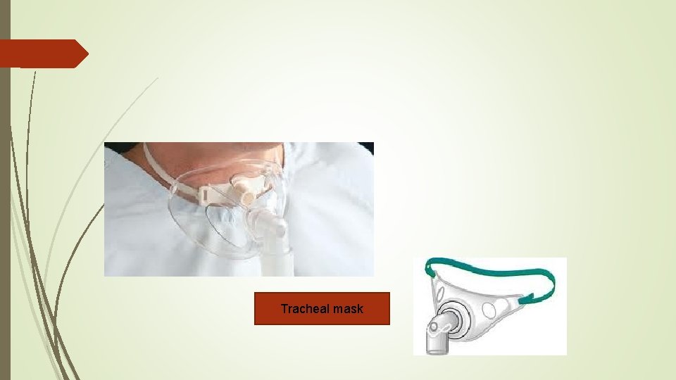Tracheal mask 
