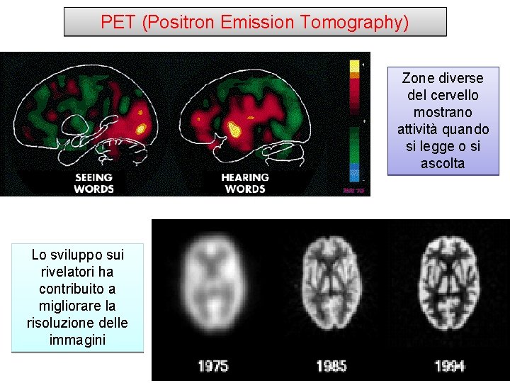 PET (Positron Emission Tomography) Zone diverse del cervello mostrano attività quando si legge o