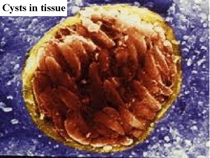 Cysts in tissue 