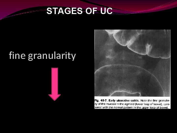STAGES OF UC fine granularity 