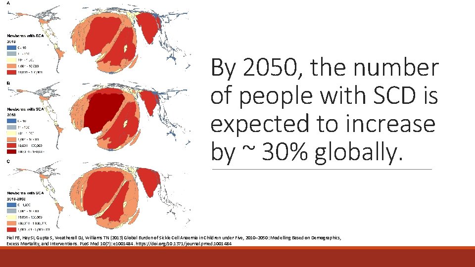 By 2050, the number of people with SCD is expected to increase by ~