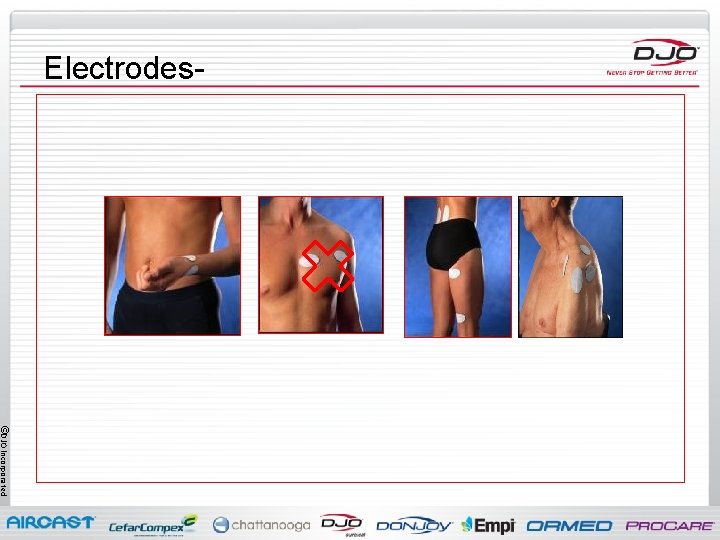 Electrodes- ©DJO Incorporated 