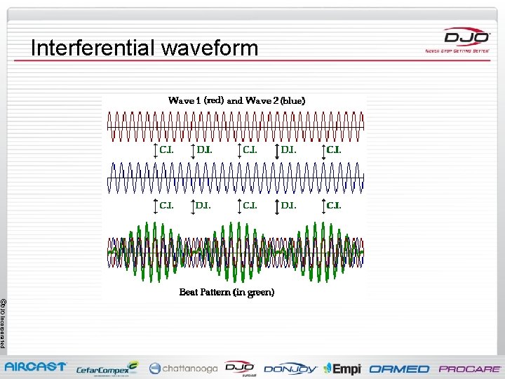 Interferential waveform ©DJO Incorporated 