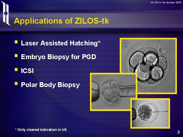 ZILOS-tk- November 2005 Applications of ZILOS-tk § Laser Assisted Hatching* § Embryo Biopsy for