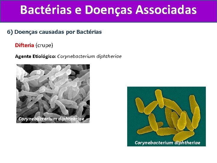 Bactérias e Doenças Associadas 6) Doenças causadas por Bactérias Difteria (crupe) Difteria Agente Etiológico: