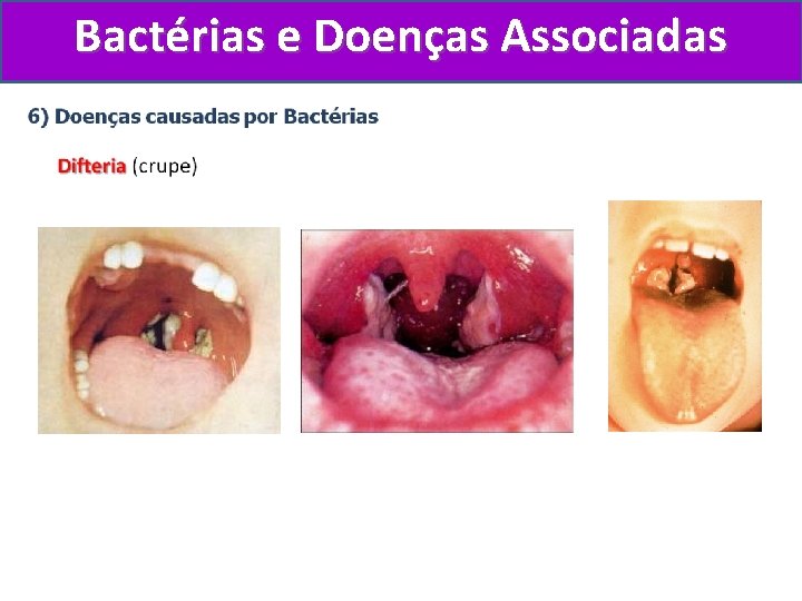 Bactérias e Doenças Associadas 
