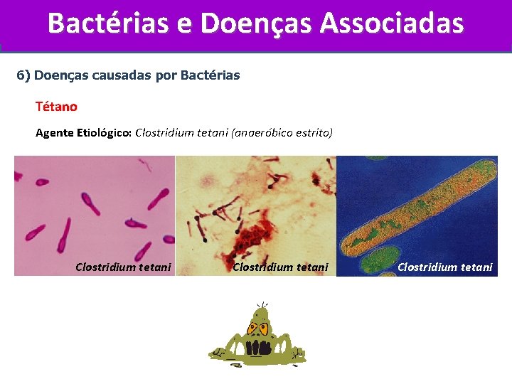 Bactérias e Doenças Associadas 6) Doenças causadas por Bactérias Tétano Agente Etiológico: Clostridium tetani