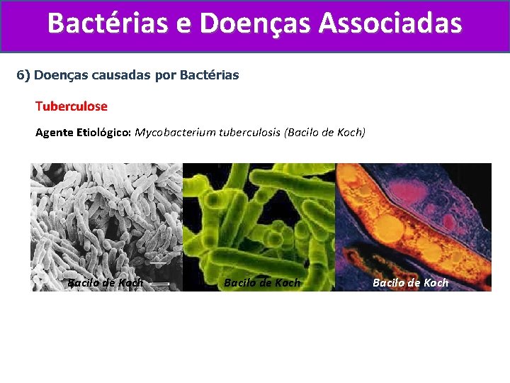 Bactérias e Doenças Associadas 6) Doenças causadas por Bactérias Tuberculose Agente Etiológico: Mycobacterium tuberculosis