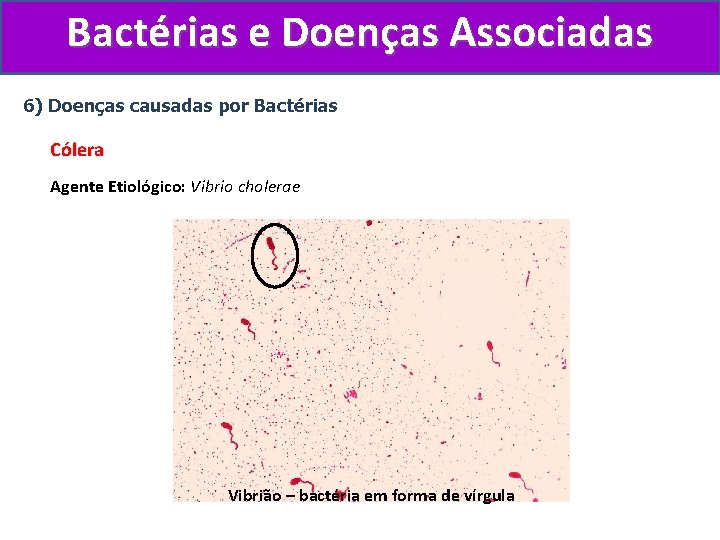 Bactérias e Doenças Associadas 6) Doenças causadas por Bactérias Cólera Agente Etiológico: Vibrio cholerae