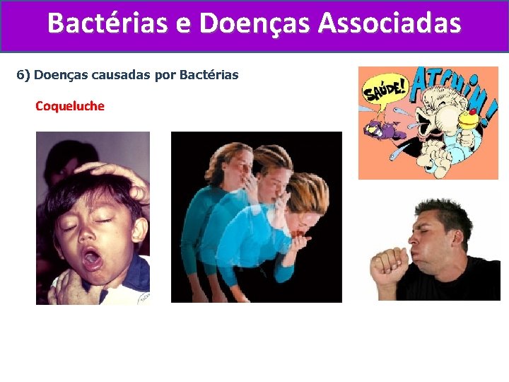 Bactérias e Doenças Associadas 6) Doenças causadas por Bactérias Coqueluche 