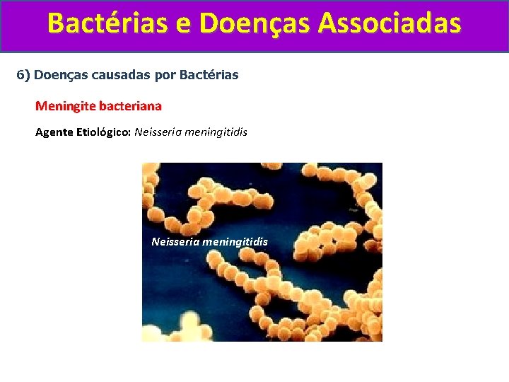 Bactérias e Doenças Associadas 6) Doenças causadas por Bactérias Meningite bacteriana Agente Etiológico: Neisseria