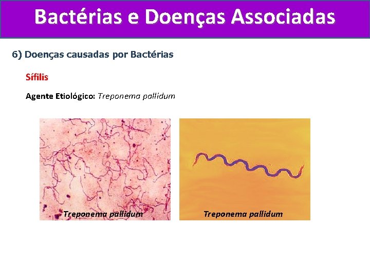 Bactérias e Doenças Associadas 6) Doenças causadas por Bactérias Sífilis Agente Etiológico: Treponema pallidum
