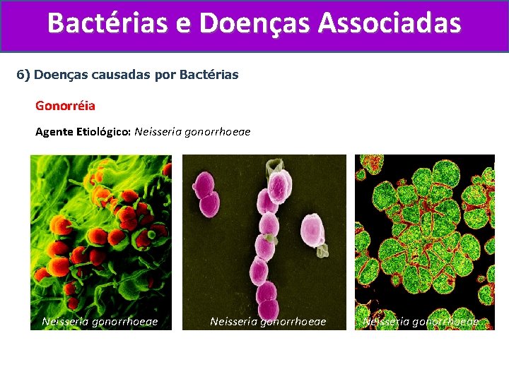 Bactérias e Doenças Associadas 6) Doenças causadas por Bactérias Gonorréia Agente Etiológico: Neisseria gonorrhoeae