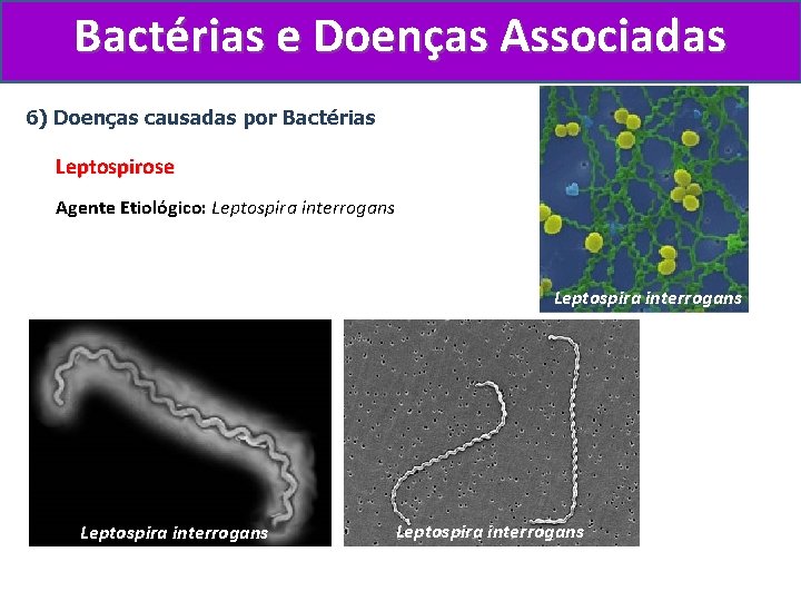 Bactérias e Doenças Associadas 6) Doenças causadas por Bactérias Leptospirose Agente Etiológico: Leptospira interrogans