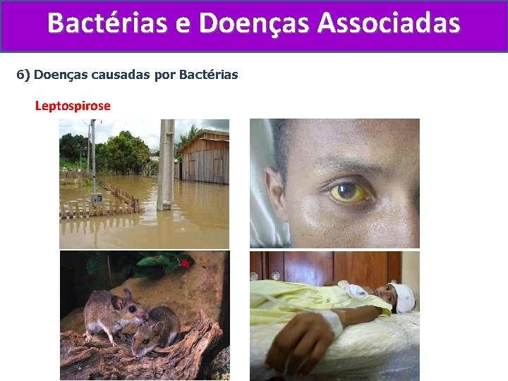 Bactérias e Doenças Associadas 6) Doenças causadas por Bactérias Leptospirose 