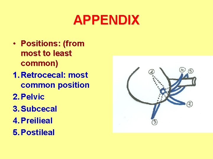 APPENDIX • Positions: (from most to least common) 1. Retrocecal: Retrocecal most common position