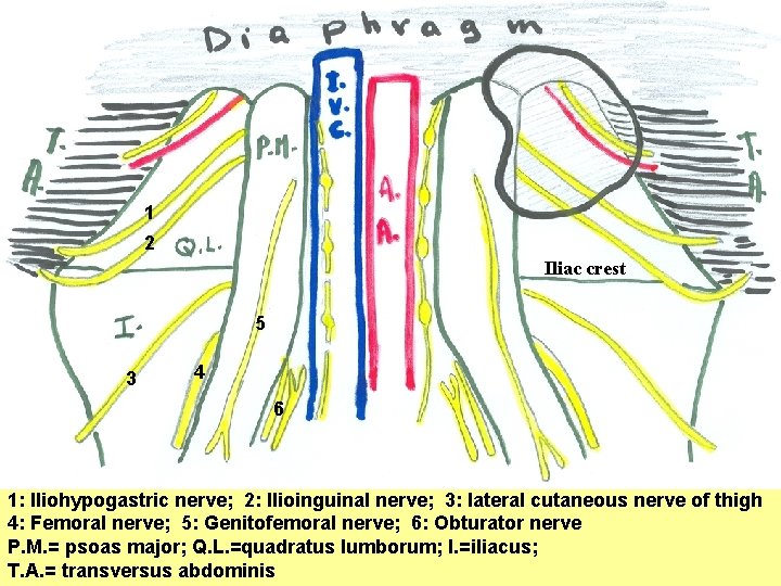 1 2 Iliac crest 5 3 4 6 1: Iliohypogastric nerve; 2: Ilioinguinal nerve;