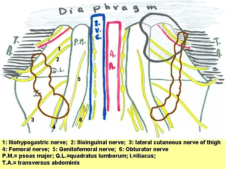 1 2 5 3 6 4 1: Iliohypogastric nerve; 2: Ilioinguinal nerve; 3: lateral