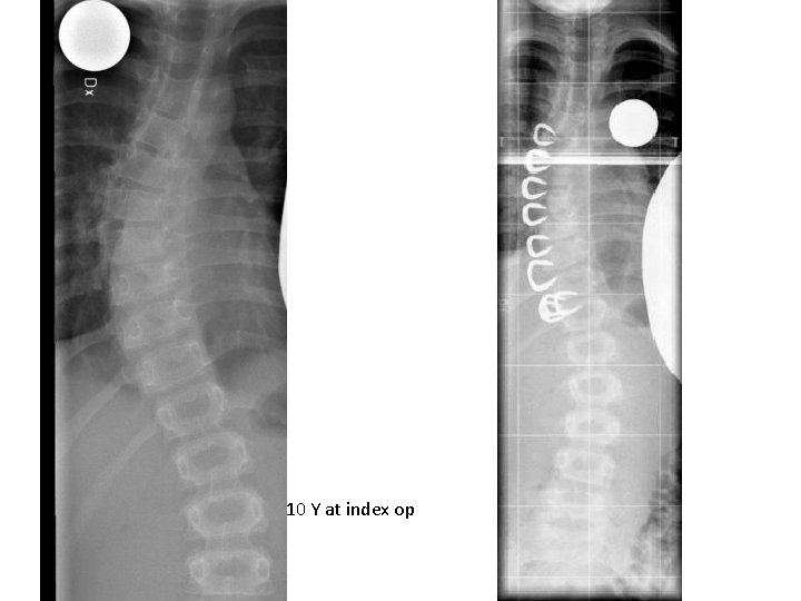 10 Y at index op 