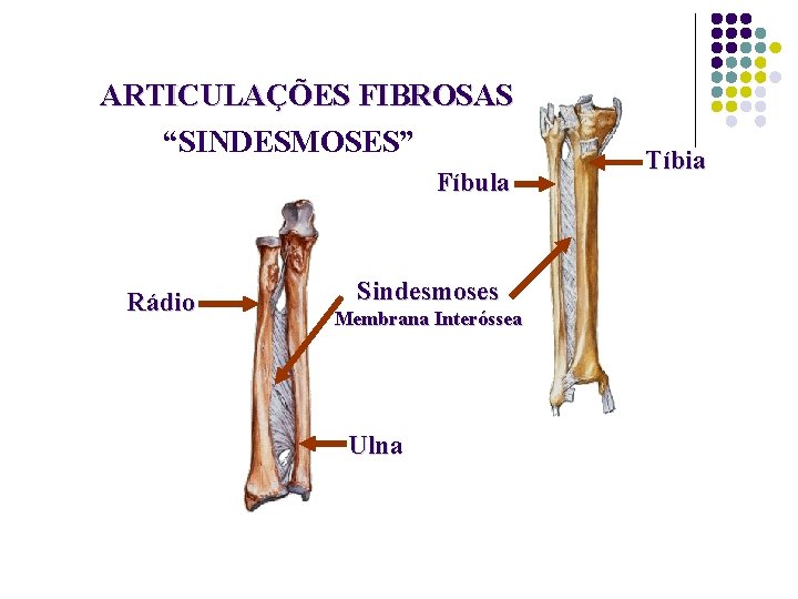 ARTICULAÇÕES FIBROSAS “SINDESMOSES” Fíbula Rádio Sindesmoses Membrana Interóssea Ulna Tíbia 