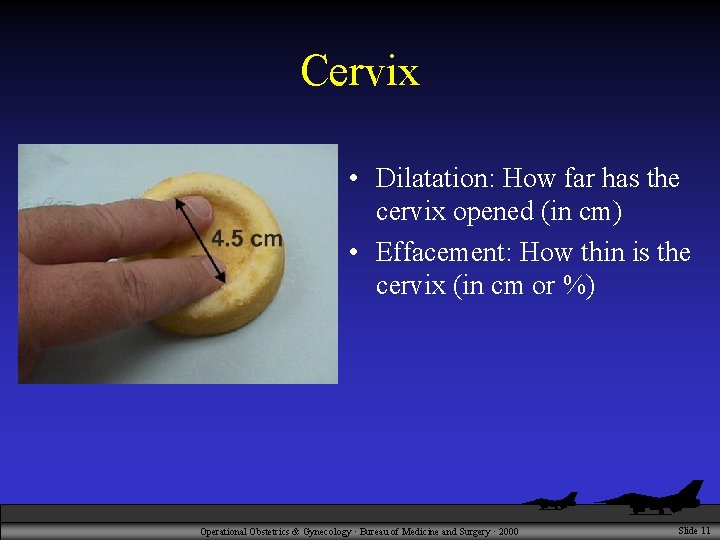 Cervix • Dilatation: How far has the cervix opened (in cm) • Effacement: How