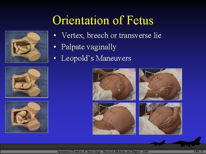 Orientation of Fetus • Vertex, breech or transverse lie • Palpate vaginally • Leopold’s