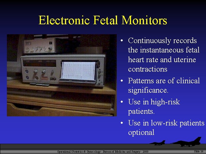 Electronic Fetal Monitors • Continuously records the instantaneous fetal heart rate and uterine contractions