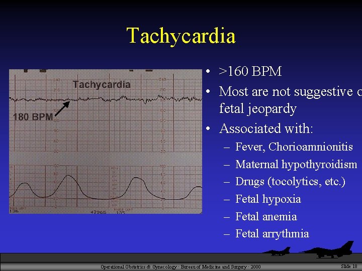 Tachycardia • >160 BPM • Most are not suggestive o fetal jeopardy • Associated